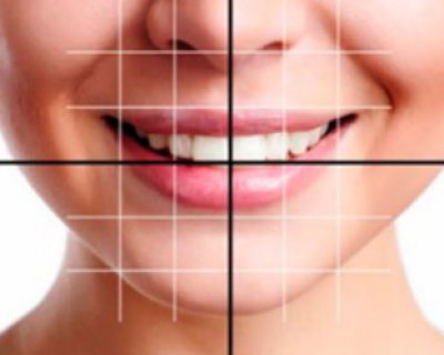 Aesthetic Dentistry (Smile Designing)